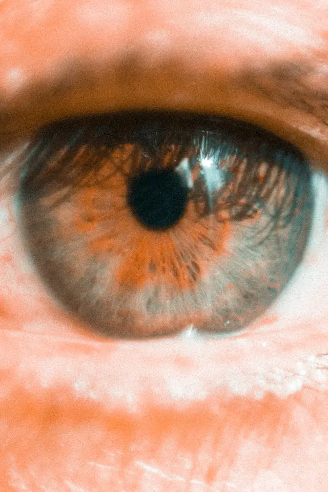 Eye Eye