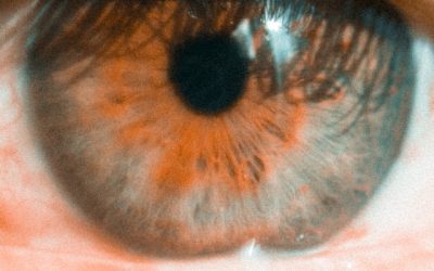 A Berry Good Remedy for Itchy, Dry Autumn Eyes—and Dry Eye Disease